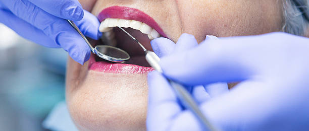 Best Emergency Treatment for Oral Infections in St Marys, WV